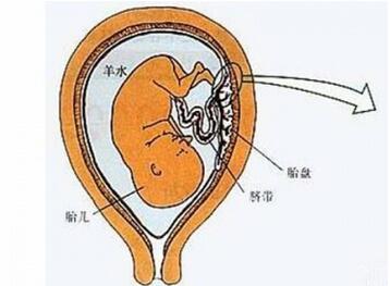 血性羊水的原因有哪些