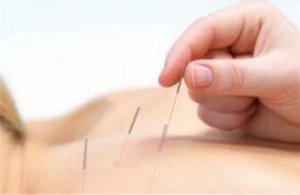 针灸的作用和坏处