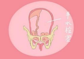 羊水栓塞死亡率极高 哪些孕妇最容易出现