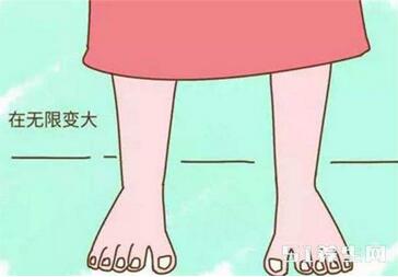 孕妇水肿对胎儿有影响吗