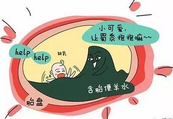 胎粪吸入综合征对婴儿以后的影响