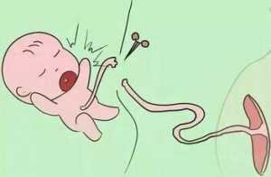 脐带被剪断那一刻，宝宝和妈妈谁更疼