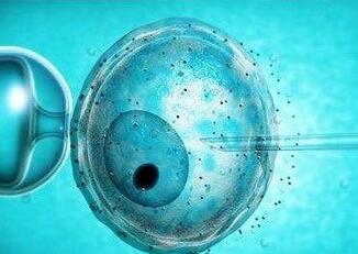 什么是体外受精