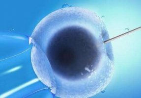 什么是体外受精