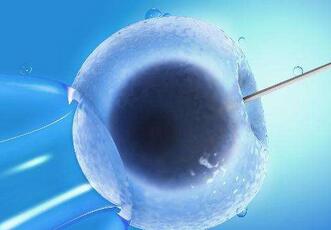 什么是体外受精