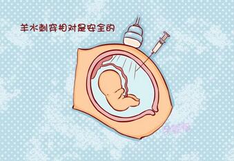 做完羊水穿刺后的纱布几天拿掉