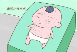 幼儿急疹和痱子的区别
