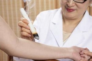 2019年三伏灸的好处