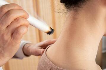 三伏灸可以去湿气吗