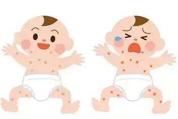 热痱子和湿疹的区别