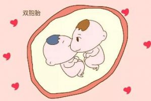 生双胞胎取决于谁 生双胞胎的秘诀