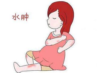 孕妇水肿跟胖的区别