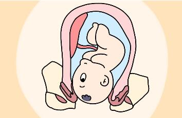 胎中胎是什么原因造成