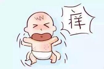 宝宝身上起红疙瘩像蚊子咬的那种