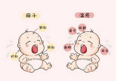 宝宝口水疹与湿疹的区别