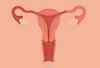 服食子宫收缩汤剂