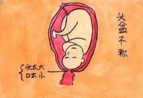 头盆不称是什么意思