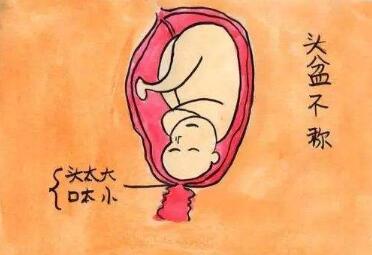 头盆不称是什么意思