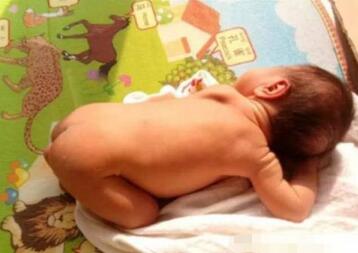 新生儿晒太阳注意事项