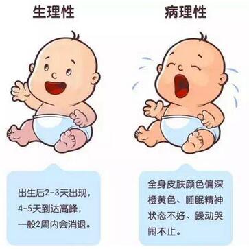 新生儿黄疸的症状