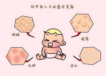 婴儿湿疹怎么办