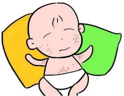 预防婴幼儿湿疹要注意