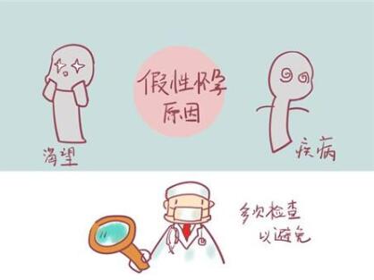 假性怀孕的表现