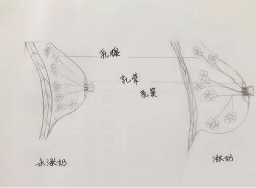 有一种痛，叫产后涨奶