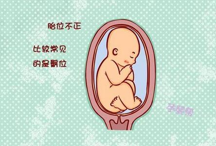 胎位不正怎么办