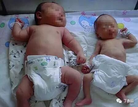 孕期该如何锻炼