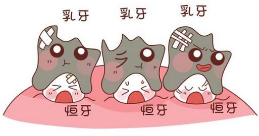 婴儿多大开始刷牙