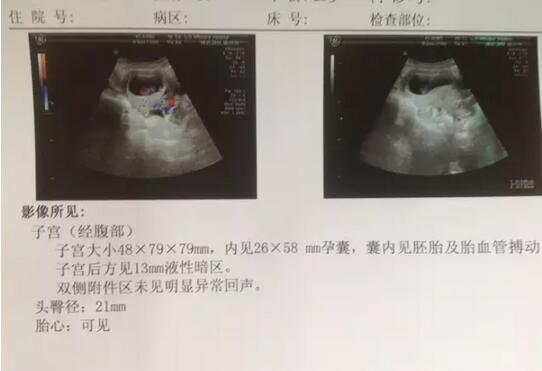 b超单子怎么看男女