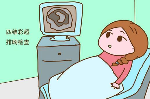 四维彩超的作用