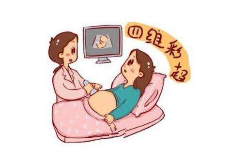 孕期一定要去做的四维彩超