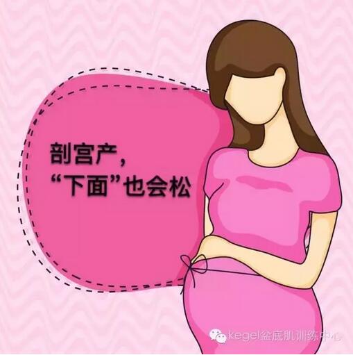 产后恢复，修复阴道松弛