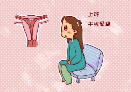 为什么不建议女人上环