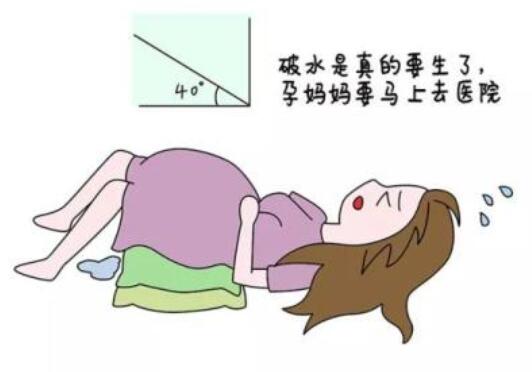 孕期高位破水是怎么回事