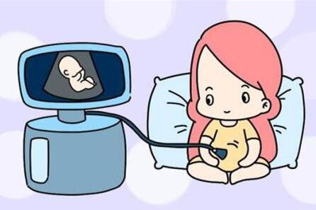 胎心监护的作用