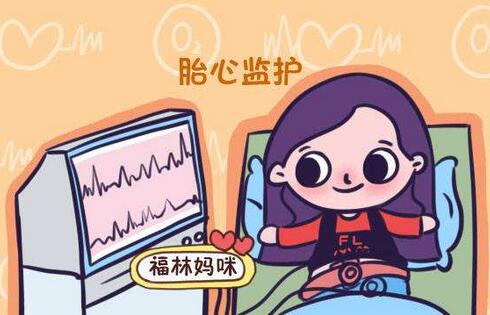 胎心监护的作用