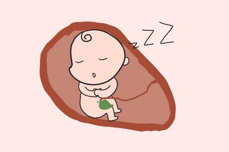 胎儿脐带绕颈怎么办