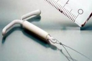 上环和取环哪个更痛苦