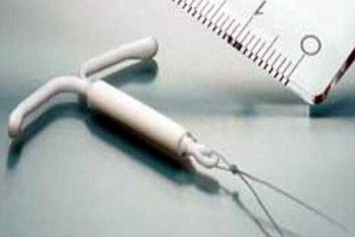 上环和取环哪个更痛苦