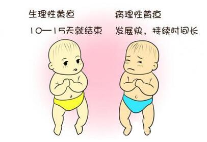 新生儿黄疸