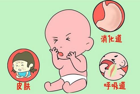 宝宝食物过敏症状