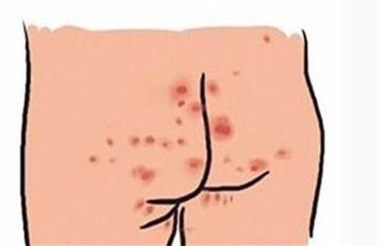 小孩口足手病轻微图片越早认识