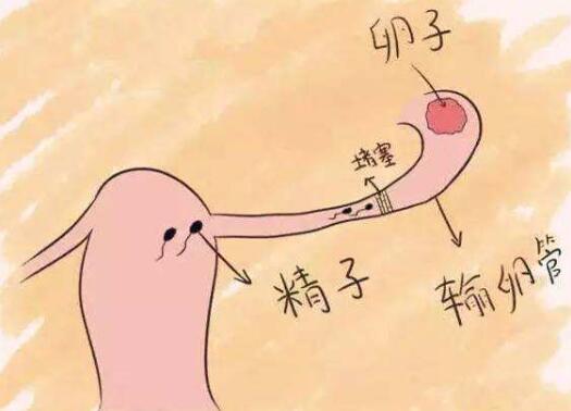 输卵管堵塞有什么样症状