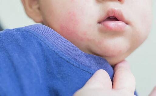 防止宝宝秋天又干又红又糙，做好这两个字就可以