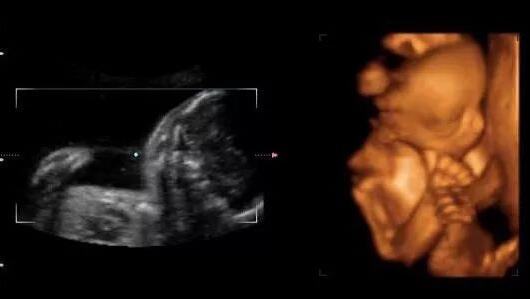 孕期征兆暗示你生男孩!