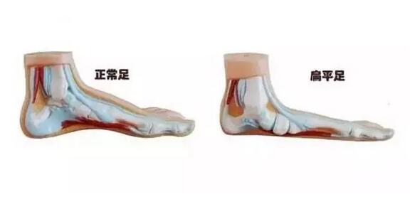 宝宝要不要光脚