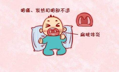 婴儿扁桃体发炎有什么症状